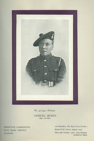 Burns S Pte