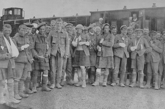 British Wounded After The Battle Of Loos